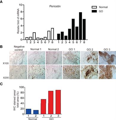 Therapeutic Potential of Targeting Periostin in the Treatment of Graves’ Orbitopathy